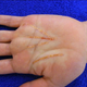 Illustration for article titled Plastic Surgeon Will Burn a Better Fortune onto Your Palm